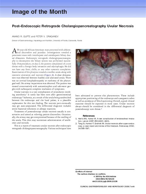 Pdf Postendoscopic Retrograde Cholangiopancreatography Uvular