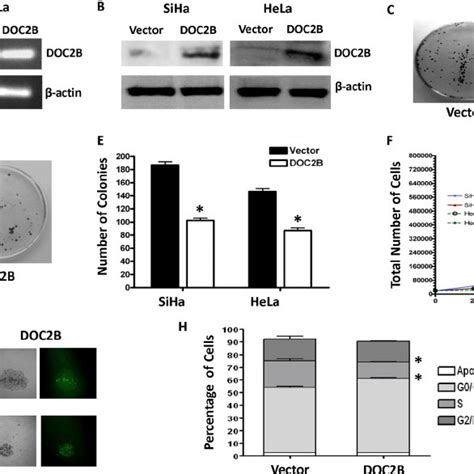 Ectopic Expression Of DOC2B Suppresses Growth And Proliferation In SiHa