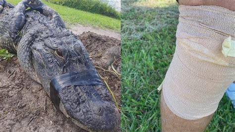 Florida man fights off alligator during attack | wtsp.com