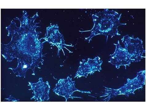 Astrazeneca Promueve Sus Retos De Mejorar Los Est Ndares De Atenci N En