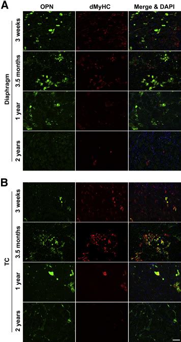 Osteopontin Opn Expression In Regenerating Muscle Fibers Of