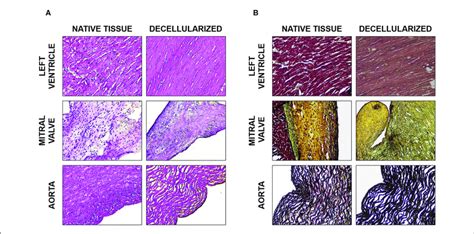 Histological Analysis A H E Staining Of The Native And