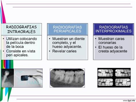 Un Espacio Para La Radiolog A Tipos De Peliculas Intraorales