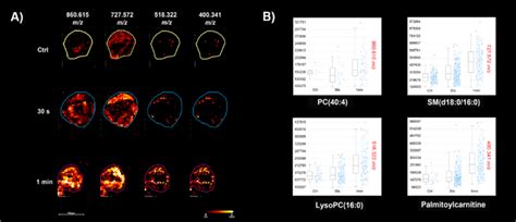 Maldi Msi Showing Time Dependent Lipid Penetration In Hydrogen Peroxide Download Scientific