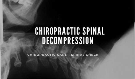 Chiropractic Spinal Decompression And Treatment By Parsa Hassan Medium