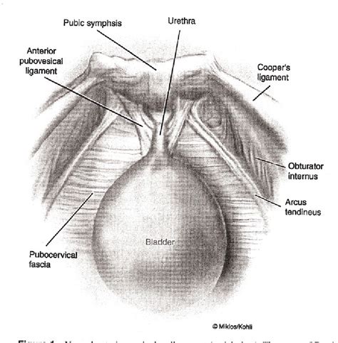 [pdf] 44 Paravaginal Repair A Laparoscopic Approach Semantic Scholar