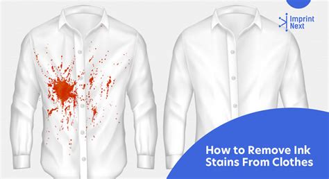 How to Remove Ink Stains From Clothes - ImprintNext Blog