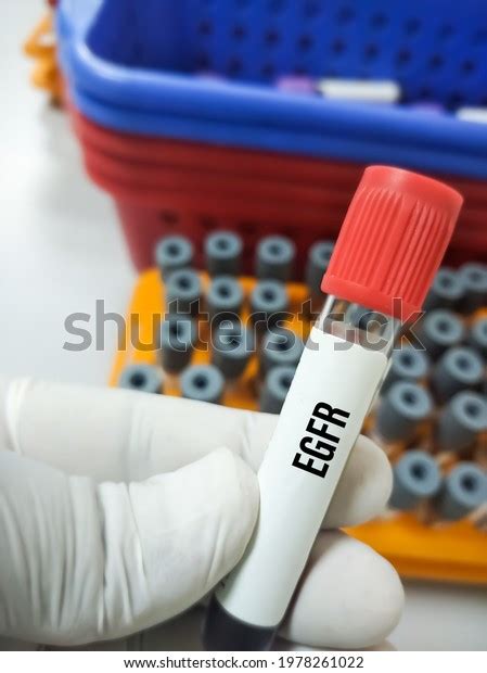 Blood Sample Egfr Estimated Glomerular Filtration库存照片1978261022