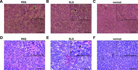 Frontiers Runting And Stunting Syndrome Is Associated With