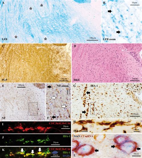 C D Microglial Clusters And Neuronal C In The Mouse Brain At Week