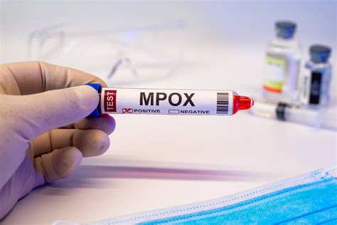 Erster Fall Der Neuen Mpox Variante In Deutschland