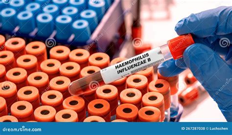 Tubo Haemophilus Influenzae B Amostra De Sangue No Laboratório De