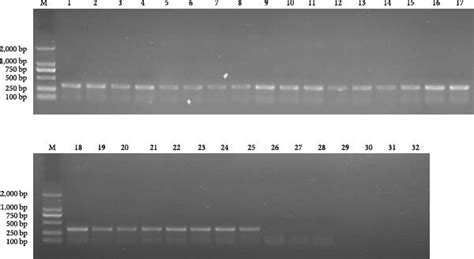 PCR Amplification Results Of XP1 Primers M DL2000 Marker 15 The