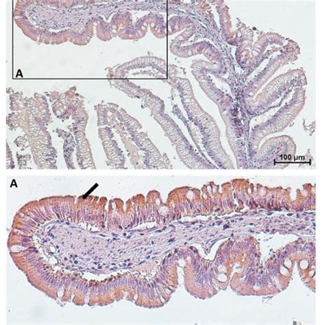 Immunolocalization Of Peptide Transporter 1 PepT1 In The Second