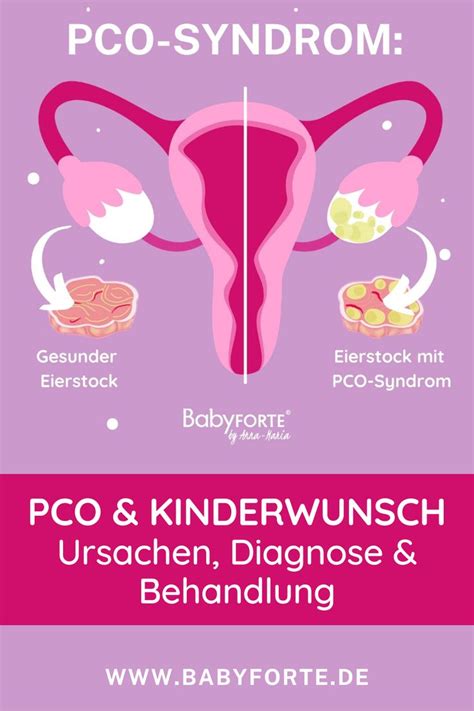 Pco Syndrom Und Kinderwunsch Ursachen Diagnose Und Behandlung Pco