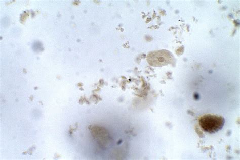 Entamoeba Coli Trophozoite Parasitology