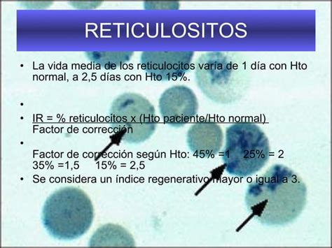 Interpretacion Del Hemograma PPT