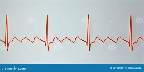 Ecg In Atrial Flutter 3d Illustration Stock Illustration