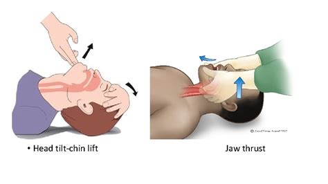 Intubation And Anatomy Of The Airway And Anesthesia