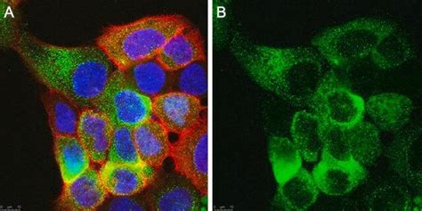 Anti α Dystroglycan Antibody Clone 3o19 H1 Zoomab® Rabbit Monoclonal