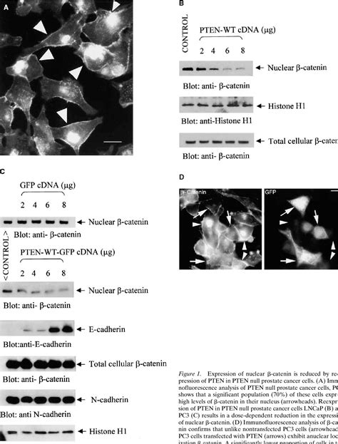 Figure 1 from Tumor Suppressor Pten Inhibits Nuclear Accumulation of β