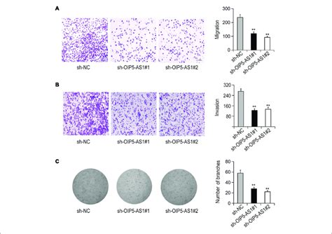 Effects Of Oip5 As1 On The Migration Invasion And Vasoformation Of