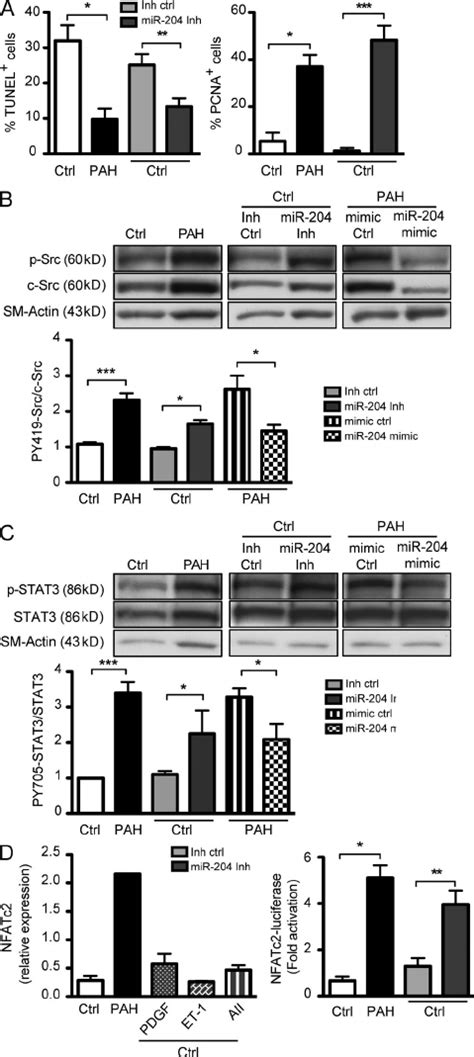 Mir 204 Modulates The Srcstat3nfatc2 Pathway In Pasmcs From A Patient