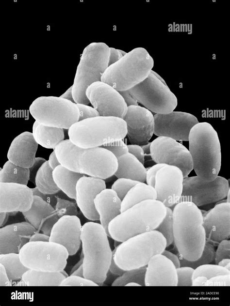 Scanning Electron Micrograph Sem Of Bordetella Pertussis Gram