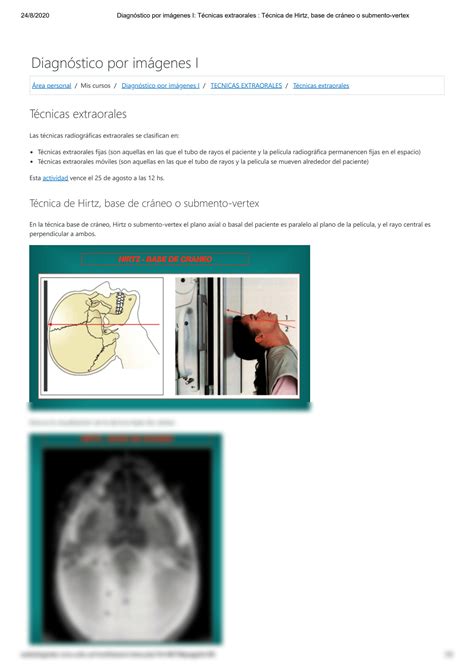 Solution Diagn Stico Por Im Genes I T Cnicas Extraorales T Cnica De