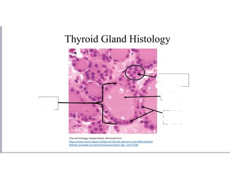 Thymus gland, histology Quiz