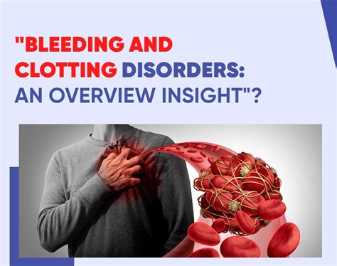 Bleeding And Clotting Disorders An Overview Insight