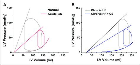 Pressure Volume Loops Illustrating The Hemodynamics Of Acute