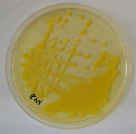Indemnisation des conséquences d’un staphylocoque doré