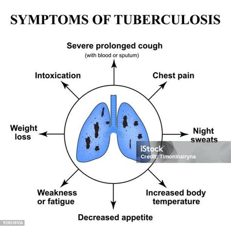 Gejala Tbc Hari Tuberkulosis Sedunia 24 Maret Struktur Paruparu