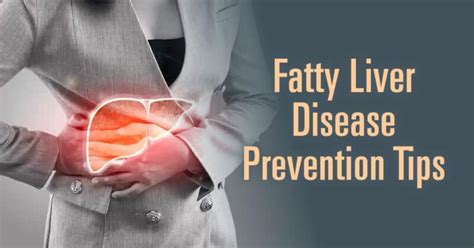 Tips To Prevent Fatty Liver Disease Russell Havranek Md