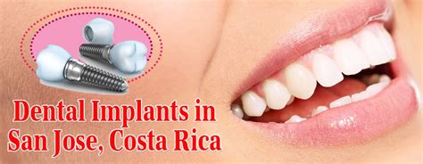 Dental Implants Costa Rica En Costa Rica Reseñas Los Precios Bookimed