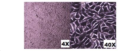 Morphology Of Human Dermal Fibroblast Hdf Cells Controls