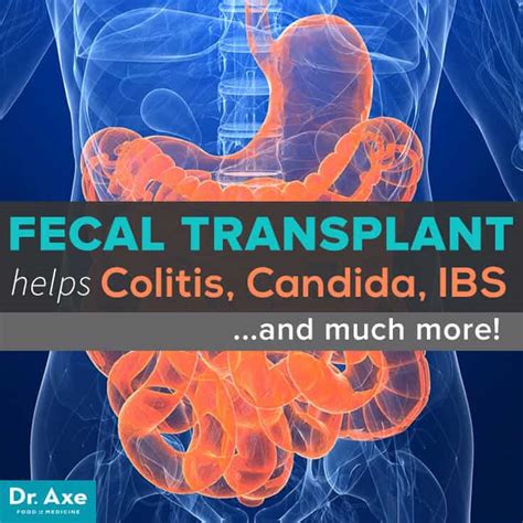 Fecal Transplants For Colitis Candida And Ibs Dr Axe