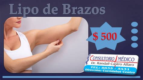 🤩🤩lipo De Brazos 😍😍 Precio Dr Randall Castro Alfaro