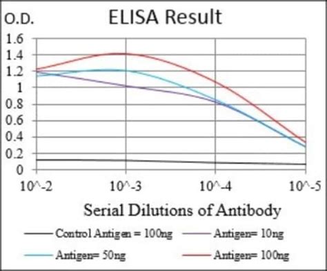 Serpin A7 TBG Antibody 1C3H11 BSA Free Novus Biologicals 0 1mL