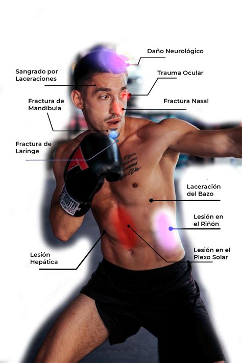 El arte violento del boxeo: entre la estética y la crueldad letal