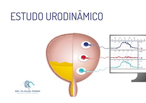 Tudo O Que Voc Precisa Saber Sobre O Estudo Urodinamico