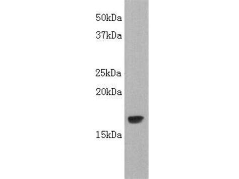 Lta Polyclonal Antibody Pa5 141176