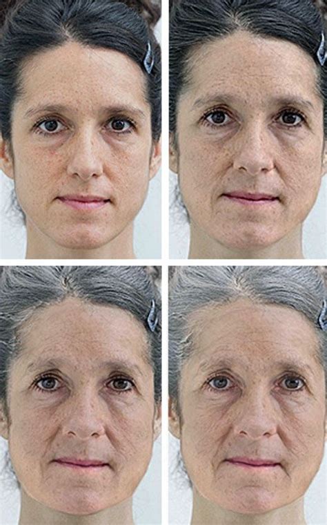 Los Cambios Faciales Que Se Producen Con La Edad Faciales Tono