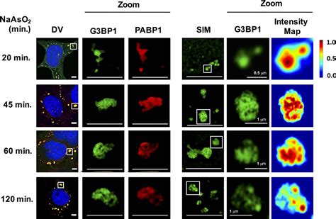 Distinct Stages In Stress Granule Assembly And Disassembly Elife