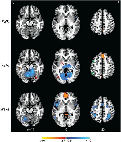 Rhythmic Alternating Patterns Of Brain Activity Distinguish Rapid Eye