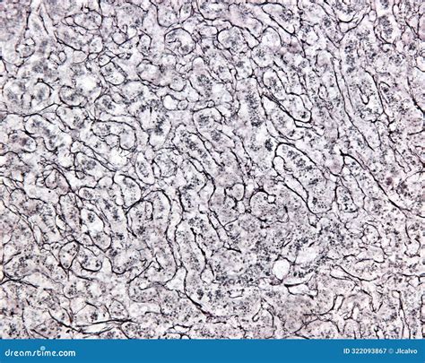 Human Liver Reticular Fibers Stock Image Image Of Light Hepatocyte