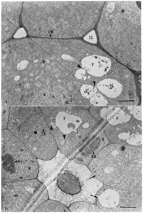 A Parts Of Adjoining Cortical Cells From A Control Root Tip The