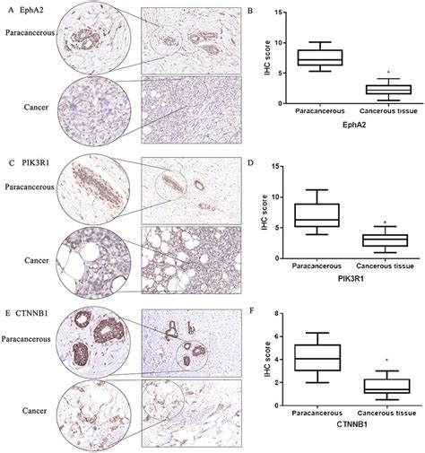 The Correlation Of Vascular Mimicry And Pik R Ctnnb In Breast Cancer