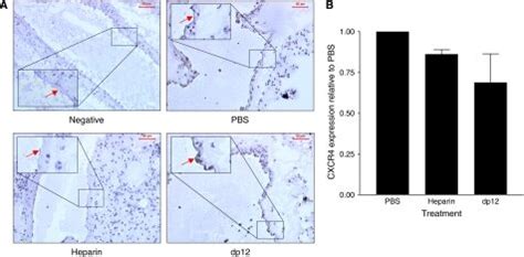 CXCL12 And CXCR4 Expression In Mouse Lung And Tumours CXCL12